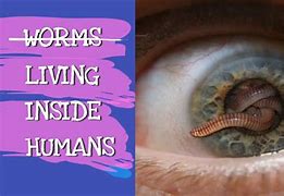 Image result for Earth Apple Worm Human