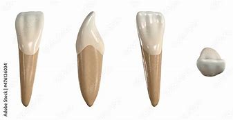 Image result for Lower Lateral Incisors