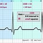 Image result for 10 Second Heart Rate Chart