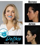 Image result for Jaw Exercise Tool