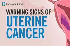 Image result for Endometrial Cancer Warning Signs