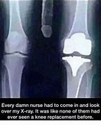 Image result for Knee X-ray Meme