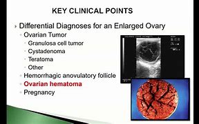 Image result for Equine Ovarian Tumor