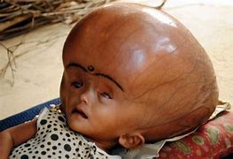 Image result for Biggest Baby Head in the World