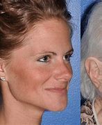 Image result for Aging Face Skin