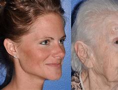 Image result for Woman Face Aging Skin