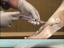 Image result for Types of PICC Line Catheters