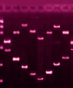 Image result for PCR Bacteria Primer