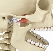 Image result for Jawbone Ear