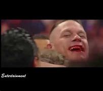 Image result for John Cena Bleeding