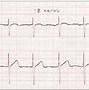Image result for cardiograf�w