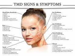 Image result for Neck Disorders