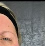 Image result for Beauty Botox