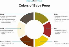 Image result for Dark Poop Toddler