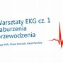 Image result for co_to_za_załamek_q