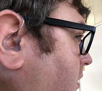 Image result for Lively Hearing Aids Review