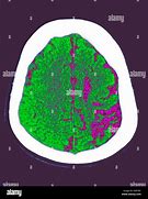 Image result for CT Scan Picture of Scanner