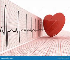 Image result for cardiogramw