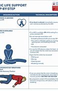 Image result for European CPR Guidelines