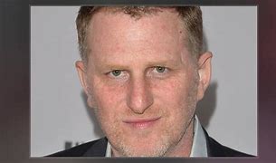 Image result for Michael Rapaport Cold Sore