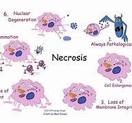 Image result for necrosis