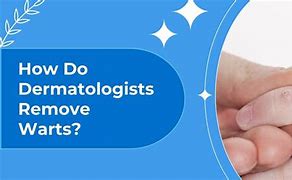 Image result for Foot Wart Removal
