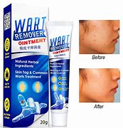 Image result for Wart Removal Cream India