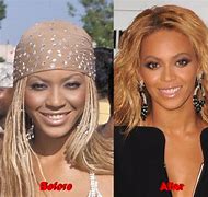 Image result for Beyoncé Facelift Tape