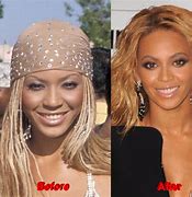 Image result for Beyoncé Skin Lightener