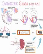 Image result for Cat Cardiogenic Shock