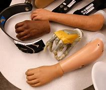 Image result for Biomedical Engineering Prosthetics