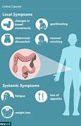 Image result for Colon Cancer Symptoms