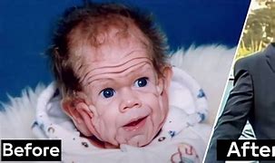 Image result for Angry Wrinkly Baby