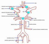 Image result for Circle of Willis