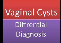 Image result for How Big Is 4 Cm Cyst