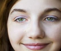Image result for Girl with Rare Eye Color