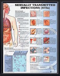 Image result for Sexually Transmitted Diseases Poster