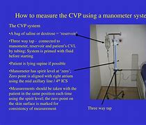 Image result for Central Venous Pressure Scale