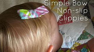 Image result for Plastic Cable Snap Clips