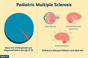 Image result for Relapsing-Remitting Multiple Sclerosis
