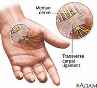 Image result for Anatomy Wrist Carpal Tunnel