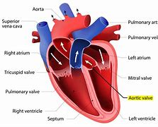 Image result for Open Heart Surgery Diagram