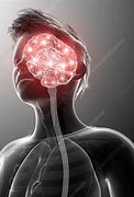 Image result for Human Brain Activity