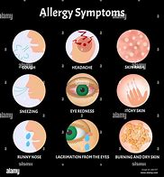 Image result for Bad Allergies