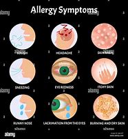 Image result for Caffeine Allergy Symptoms