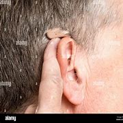 Image result for Behind the Ear (BTE) Hearing Aid