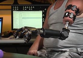 Image result for Cyborg Arm