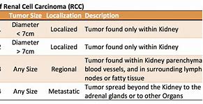 Image result for Renal Cell Carcinoma Staging