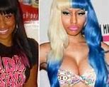 Image result for Nicki Minaj Before and After