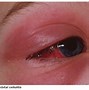 Image result for Types of Visual TV Problems